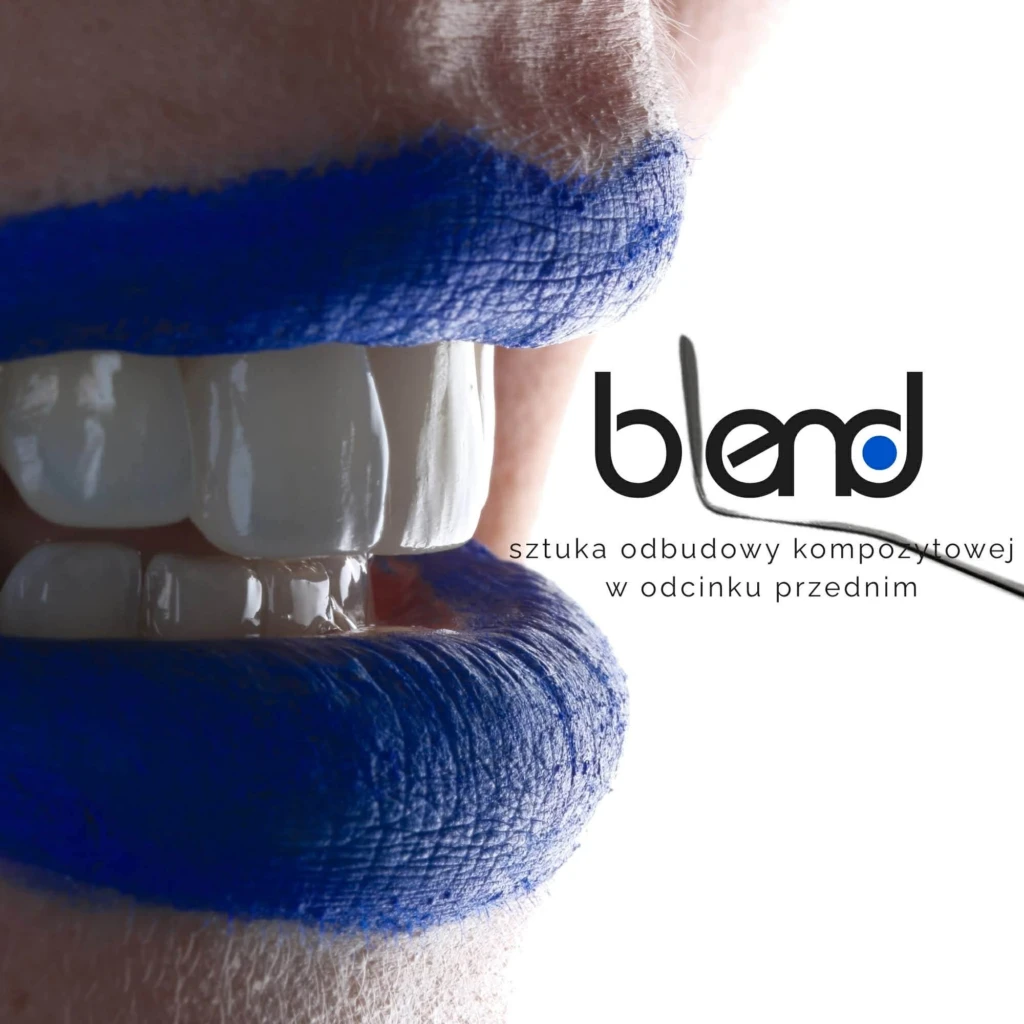 att.1s4NKr1Vgn1Pfzeo75VRfs9rwV9oiOCqGyUV7SudcLY